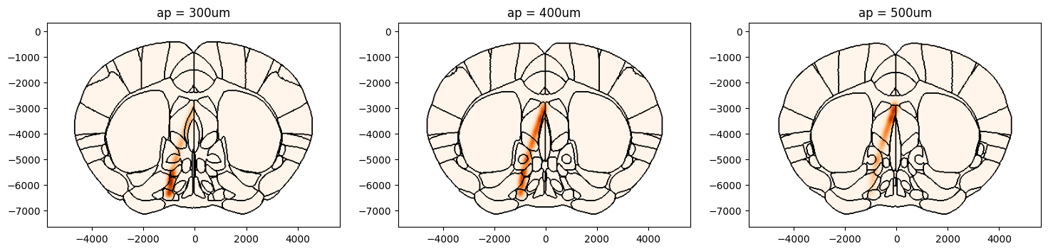 ../_images/notebooks_external_atlas_plotting_points_on_slice_15_1.png