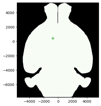 ../_images/notebooks_external_atlas_plotting_points_on_slice_17_0.png